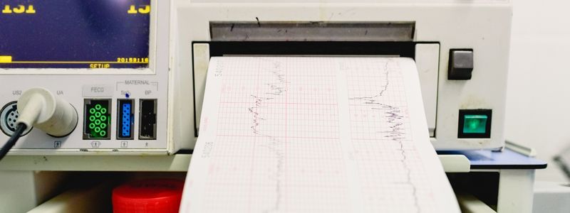electrocardiograma mujer embarazada